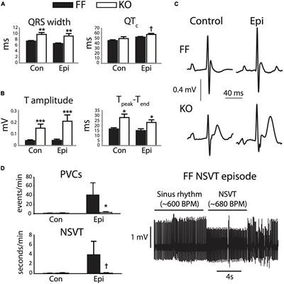 Sarcoplasmic Reticulum Calcium Release Is Required for Arrhythmogenesis in the Mouse